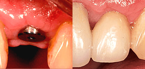 high quality alpha bio system